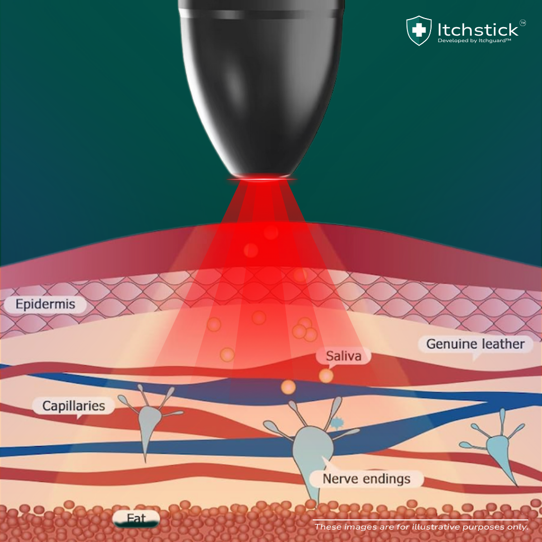 Itchstick™ Pro - Electronic Bite Relief Pen